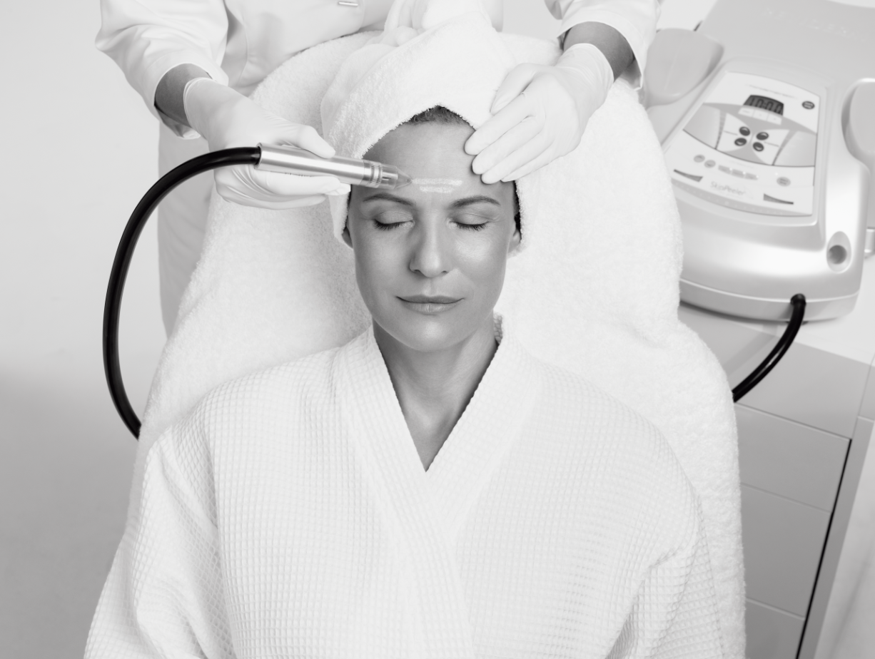 Mikrodermabrasion Behandlung bei REVIDERM skinmedics wien in 1010 Wien