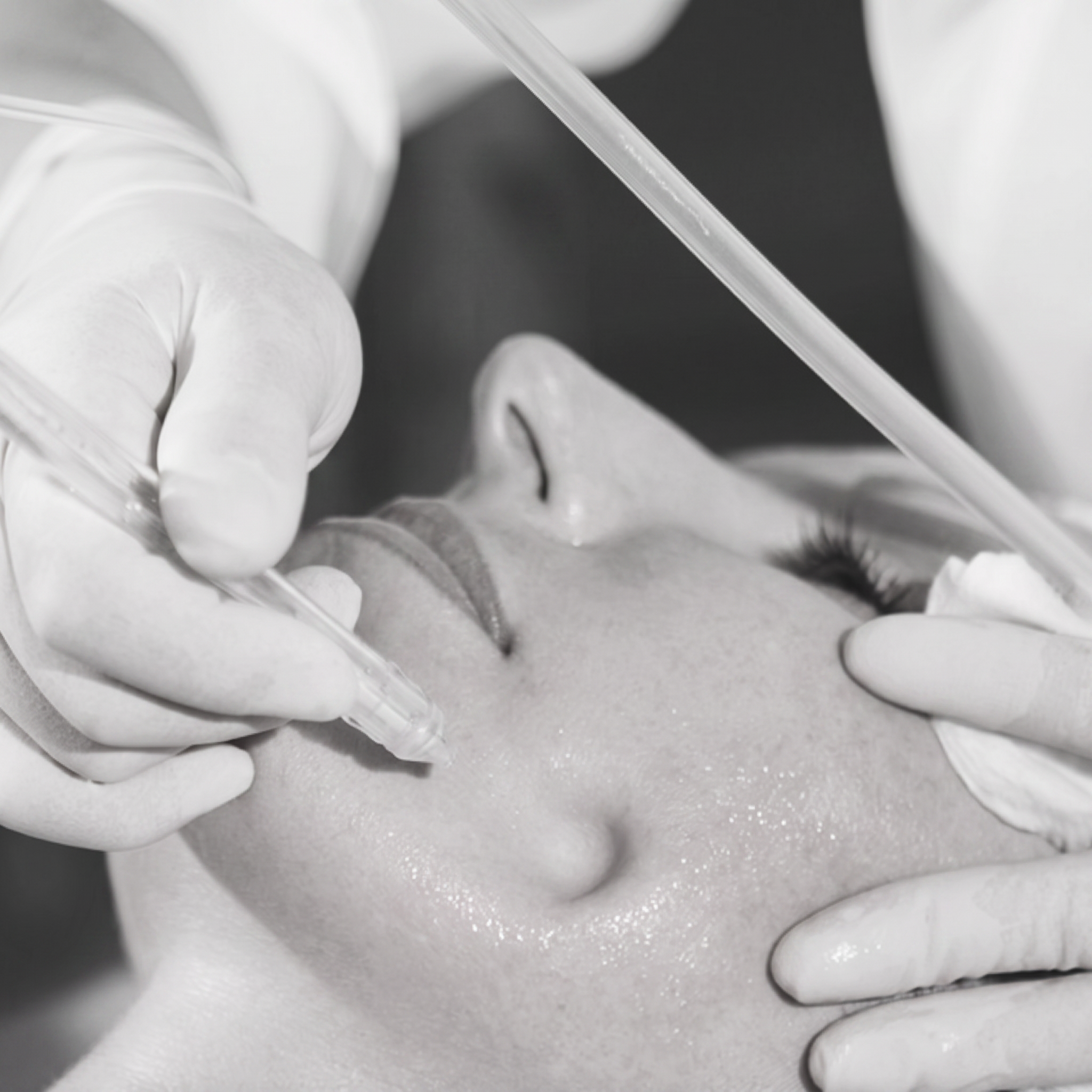 JetPeel™ Behandlung bei REVIDERM skinmedics wien in 1010 Wien