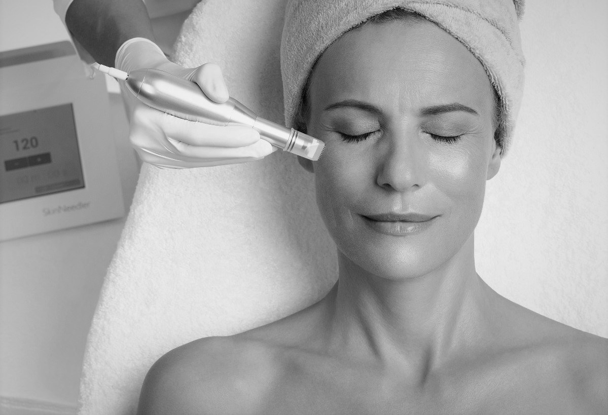 Medizinisches Microneedling – Hautstruktur bei REVIDERM skinmedics wien, 1010 Wien